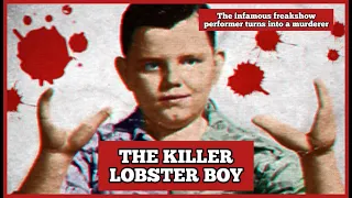 The Infamous Freak Show Performer Turns Into a Murderer | Grady Stiles "Lobster Boy"