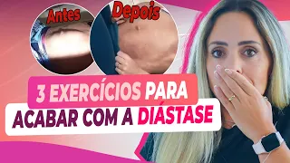 Os 3 MELHORES EXERCÍCIOS para ACABAR com a DIÁSTASE ABDOMINAL