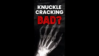 Is cracking your knuckles bad? #shorts