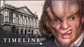 The Victorian Hospital Of Joseph Merrick, The Elephant Man | Hidden History Of Britain | Timeline