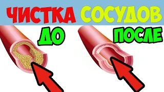 10 САМЫХ ЛУЧШИХ ПРОДУКТОВ которые ЧИСТЯТ СОСУДЫ и снижают риск инфарктов