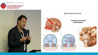 Неврологический статус для оценки эффективности лечения. Царенко С.В.