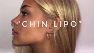 “chin lipo” remove double chin | 𝕗𝕠𝕣𝕔𝕖𝕕 𝕤𝕦𝕓𝕝𝕚𝕞𝕚𝕟𝕒𝕝