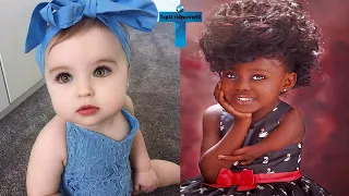 Top 10 Most Unusual Kids Around The World   Kids With Unique Features