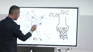 Heterotopic tricuspid valves: to who, when and how? - EuroPCR 2024