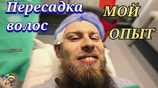 Пересадка волос в Турции: То о чём молчат! ‎@hairneva_hairtransplant 