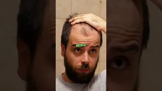 How to Use Minoxidil to Regrow Hair