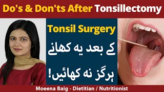 Do's And Don'ts After Tonsil Surgery |What To Eat After Tonsillectomy | Diet After Tonsillectomy