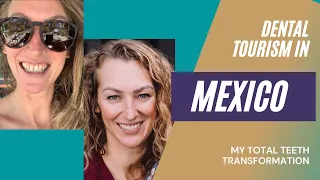 Dental Tourism In Mexico | Total Teeth Transformation