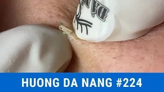 #224 | Huong Da Nang