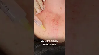 Жидкие бионити DERLI Fibrolift Soft и пептидно-аминокислотный комплекс Aurevitelli Pepto AMINOVIT