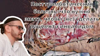 Видеолекция "Посттромботическая болезнь: что нужно знать, чтобы не сделать пациента инвалидом"