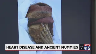 KCTV | Study Led by Saint Luke's Mid America Heart Institute Finds Heart Disease in Mummies