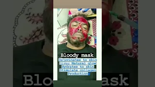 vampire facial,bloody mask