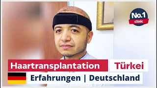 Haartransplantation Türkei | Erfahrung aus Deutschland | Zürich Klinik