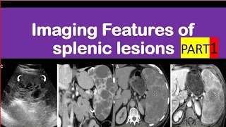 Cystic splenic lesions