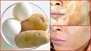 GET INSTANT FACE LIFT NATURALLY AT HOME TRANSFORM YOUR SKIN FIRM CLEAR SKIN, ANTI - AGING MASK