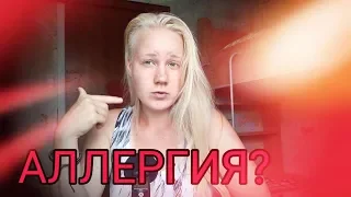 КАК УБРАТЬ АЛЛЕРГИЮ НАВСЕГДА БЕЗ ТАБЛЕТОК?