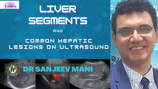 LIVER SEGMENTS & COMMON HEPATIC LESIONS ON ULTRASOUND || DR SANJEEV MANI || LIVER ULTRASOUND TIPS