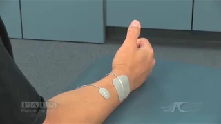 Electrode Placement for Thumb Extension