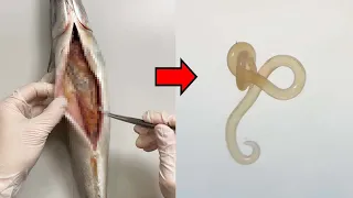 Strange Parasite Removed from Mackerel!