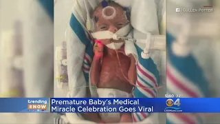 Trending: Premature Baby Celebrates