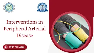 Interventions in Peripheral Arterial Disease