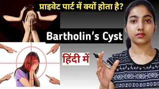 Bartholin's cyst in hindi |Causes|Symptoms|Diagnosis|Treatment|Msn|