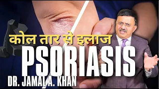 Psoriasis: Causes, Triggers and Treatments | Dr Jamal A Khan