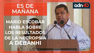 🔴 ¡Exclusiva! Mario Escobar habla acerca de los nuevos resultados de necropsia