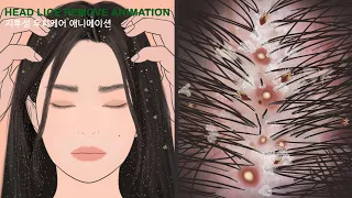 ASMR animation for removing head lice / Boredom scalp treatment