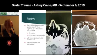 Ocular Trauma - Resident Lecture - September 2019