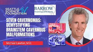 Seven Cavernomas:  Demystifying Brainstem Cavernous Malformations – Michael Lawton, MD