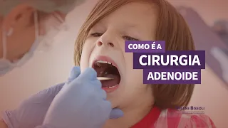 Como é a cirurgia de Adenoide? Otorrino explica