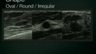 Breast Ultrasound Lesion Assessment BIRADS Ultrasound