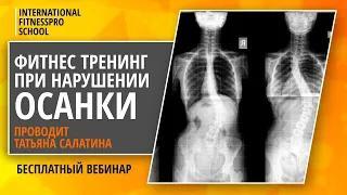 Особенности фитнес тренинга при нарушениях осанки