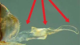 A Female Insect Has A Penis & Other Crazy Penis Truths