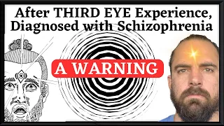 The Third Eye, Schizophrenia & Kundalini Syndrome: I Wasn’t Ready for that Level of Manifestation