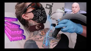 First Laser Tattoo Removal session - removing my whole chest tattoo!