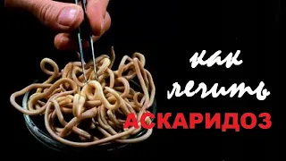 Как лечить АСКАРИДОЗ