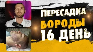 Пересадка бороды и миноксидил! Сергей Романович и Андрей Борода / 16 день / Выпуск 17