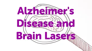 Minute Lecture: Alzheimer's Disease and Brain Lasers