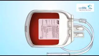 Cordlife Cord Blood Collection Process