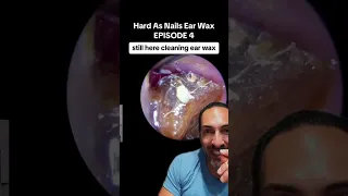 Hard as Nails Earwax Part 2