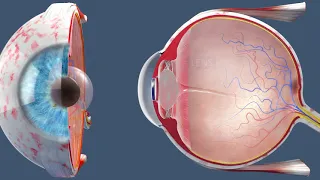 Cataract Surgery | Inside the OR