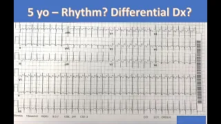 Mount Sinai Pediatric EP Conference 1/31/22