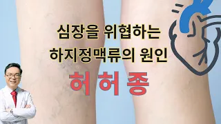 심장을 위협하는 하지정맥류의 원인 허허종의 특징과 해결법  cause of varicose vein