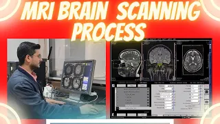 MRI Brain scanning process on siemens 1.5 tesla machine | MRI BRAIN WITH CISS sequence.