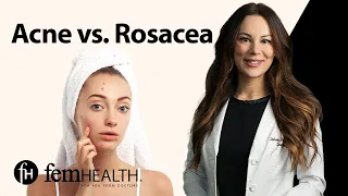 Dermatologist Explains Acne vs. Rosacea