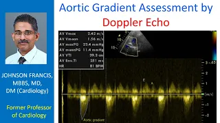 Aortic Gradient Assessment by Doppler Echo